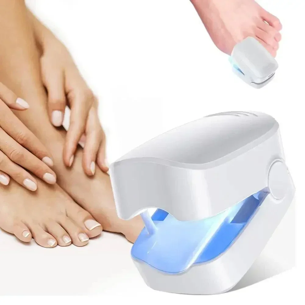 Nail fungus laser